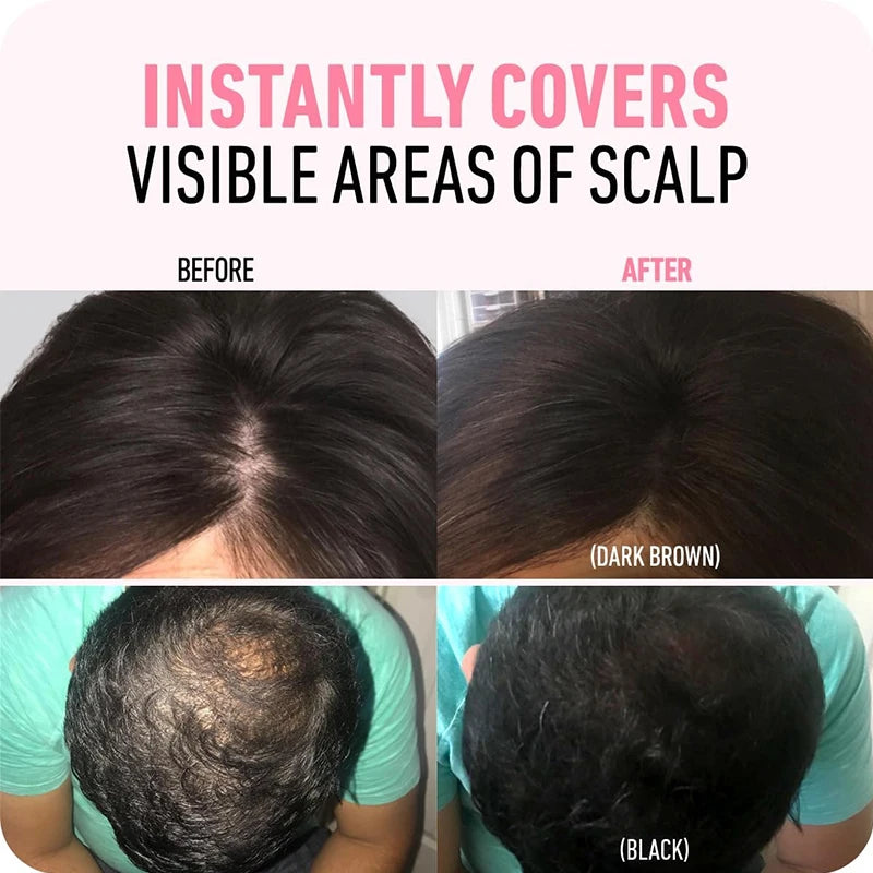 Rootiva™- Instantly Fuller Hair, Right at the Root.