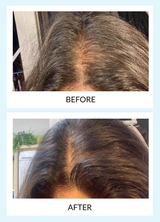 Rootiva™- Instantly Fuller Hair, Right at the Root.