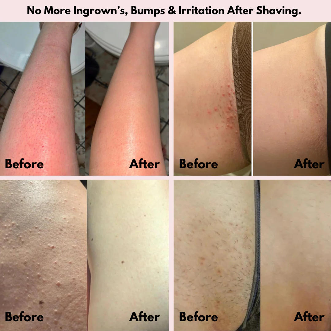 SILKA™ - Reveal Your Smoothest Self – Gentle on skin. Tough on hair.