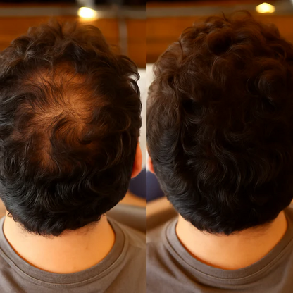 Rootiva™- Instantly Fuller Hair, Right at the Root.